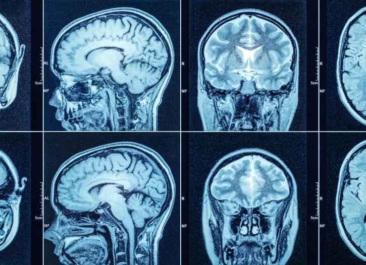 Кт головы что такое