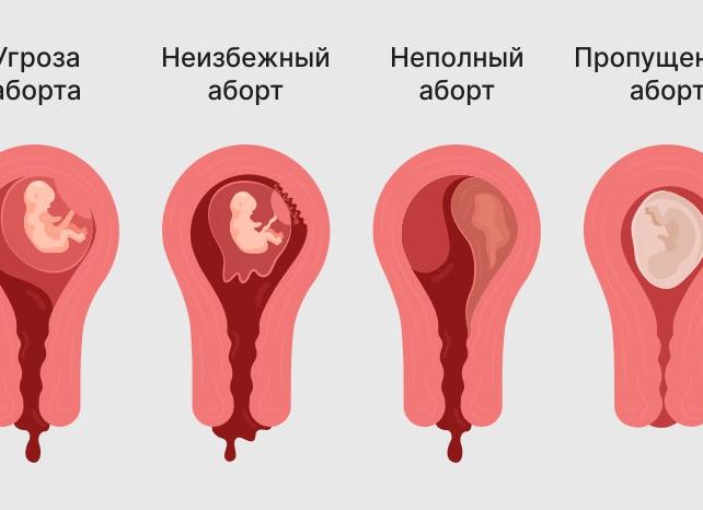 Красные выделения но не месячные и пахнут Красные выделения но не месячные и пахнут