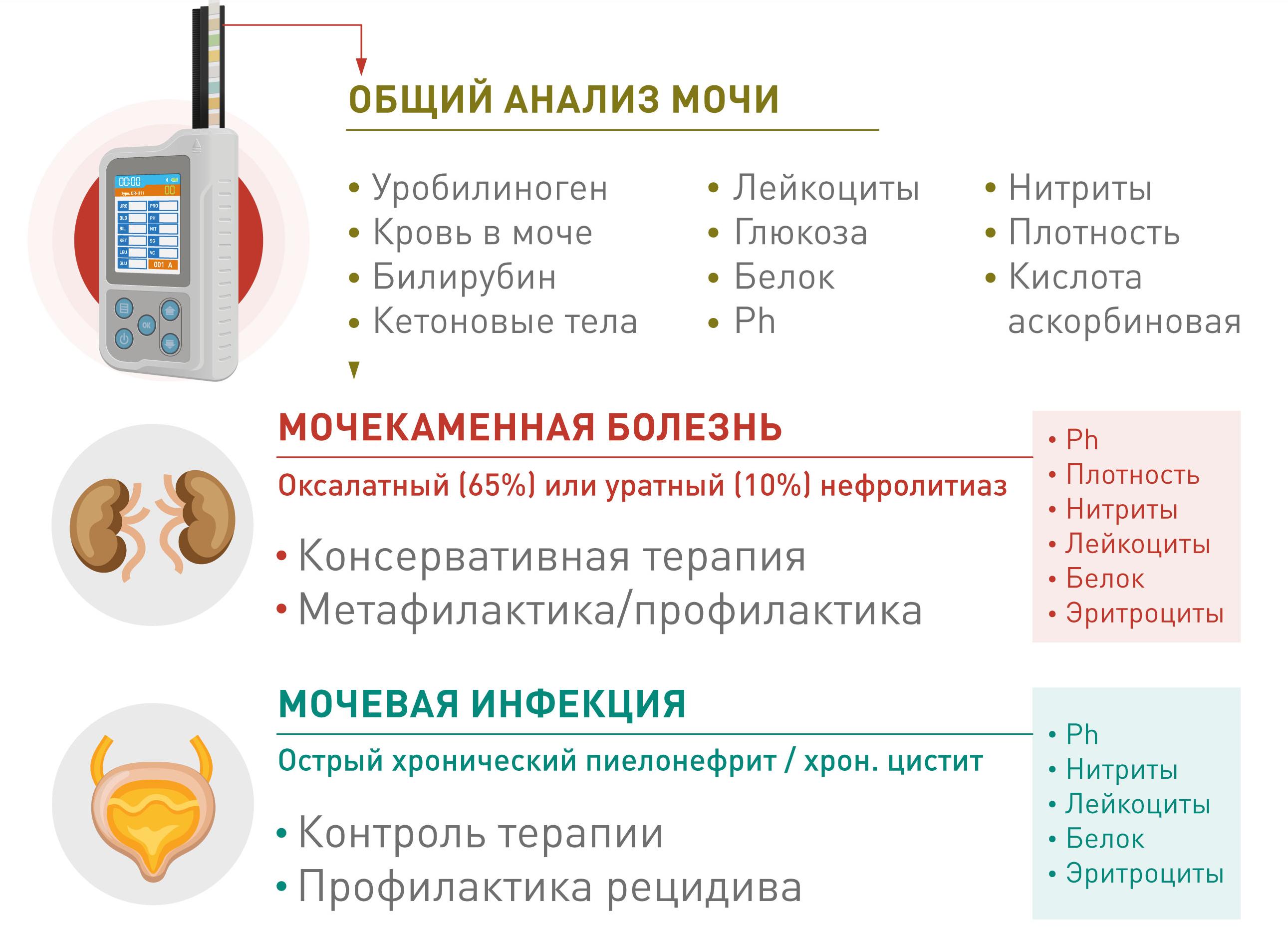 Какие бывают анализы мочи