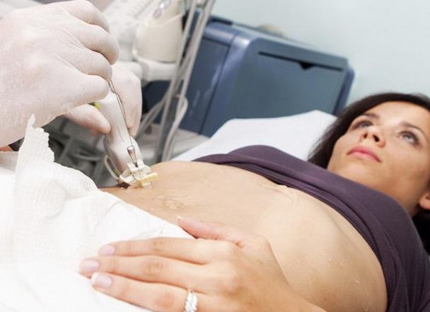 Как делается биопсия