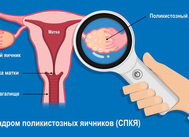 Фолликулостимулирующий гормон что это такое у женщин