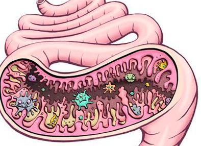 Дисбиоз что это такое