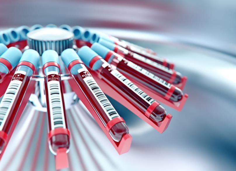 Что такое гемостазиограмма