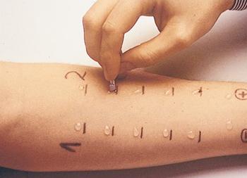 Анализ на аллергию как называется Анализ на аллергию как называется