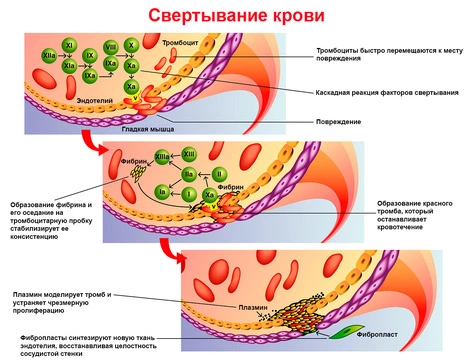 Как снизить фибриноген в крови