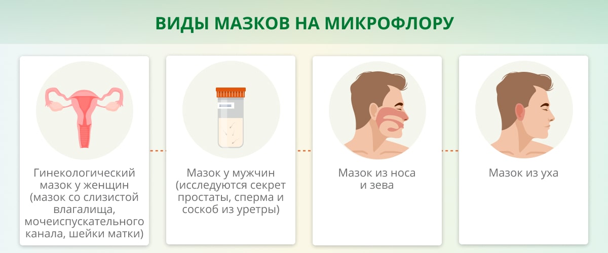 Мазок на микрофлору из зева и носа