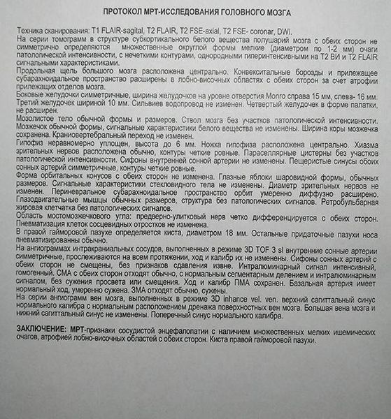 Мрт головного мозга результаты
