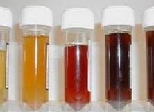 Моча красноватого цвета у женщин