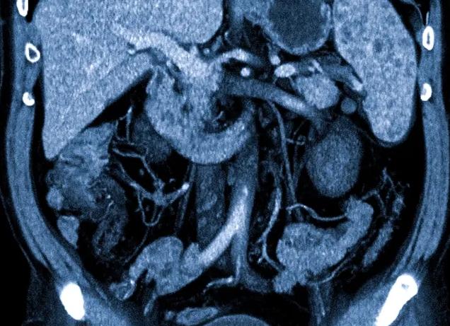 Кт желудка и кишечника что показывает