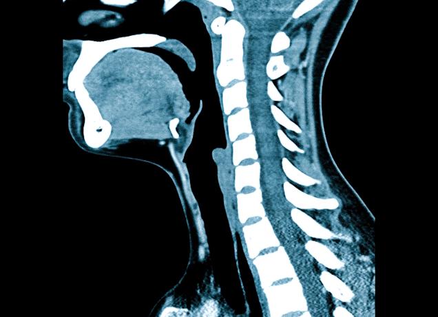 Кт мягких тканей