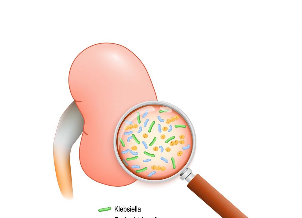 Клебсиелла пневмония у ребенка в моче