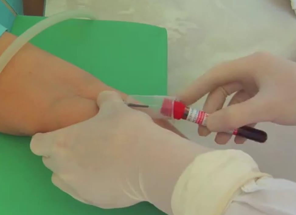 Как берут с вены кровь