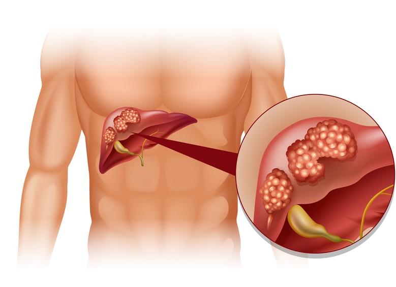 Ферменты печени алт и аст