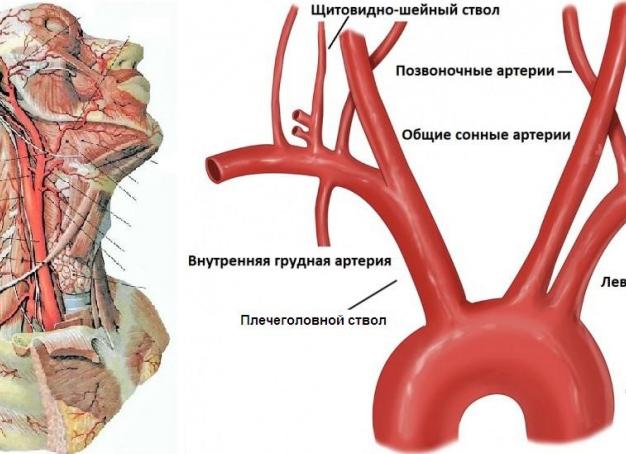 Экстракраниальный отдел брахиоцефальных артерий это