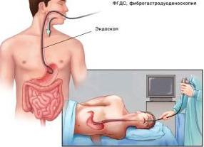 Эгдс в медицине что это