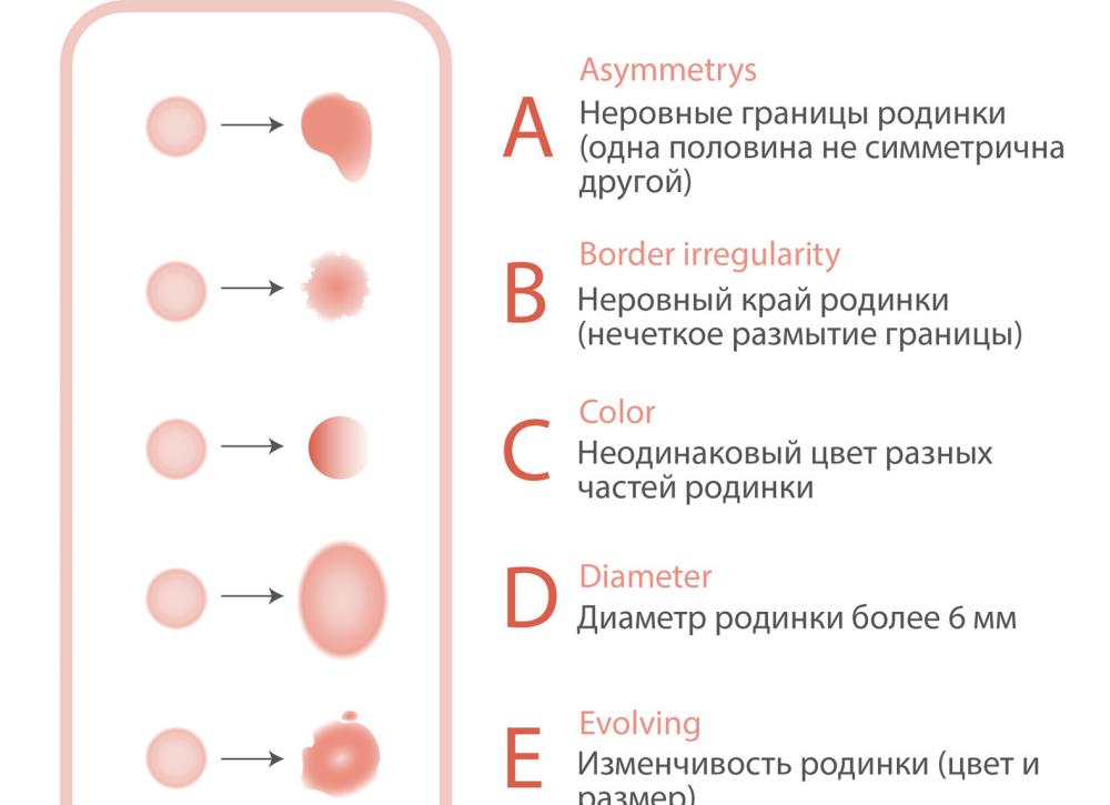 Чем обработать родинку при повреждении Чем обработать родинку при повреждении