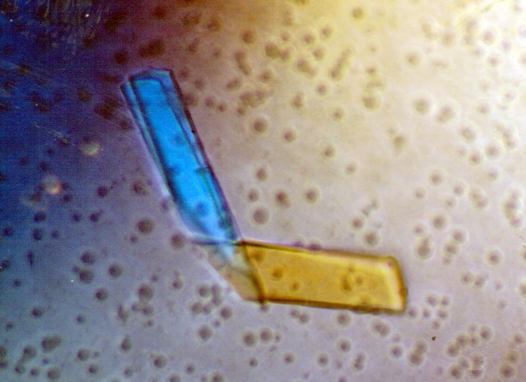 Бенс джонса белок Бенс джонса белок