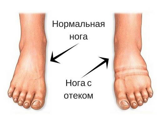 Креатинин что это