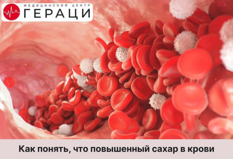 Может ли быть повышенный сахар в крови но без диабета
