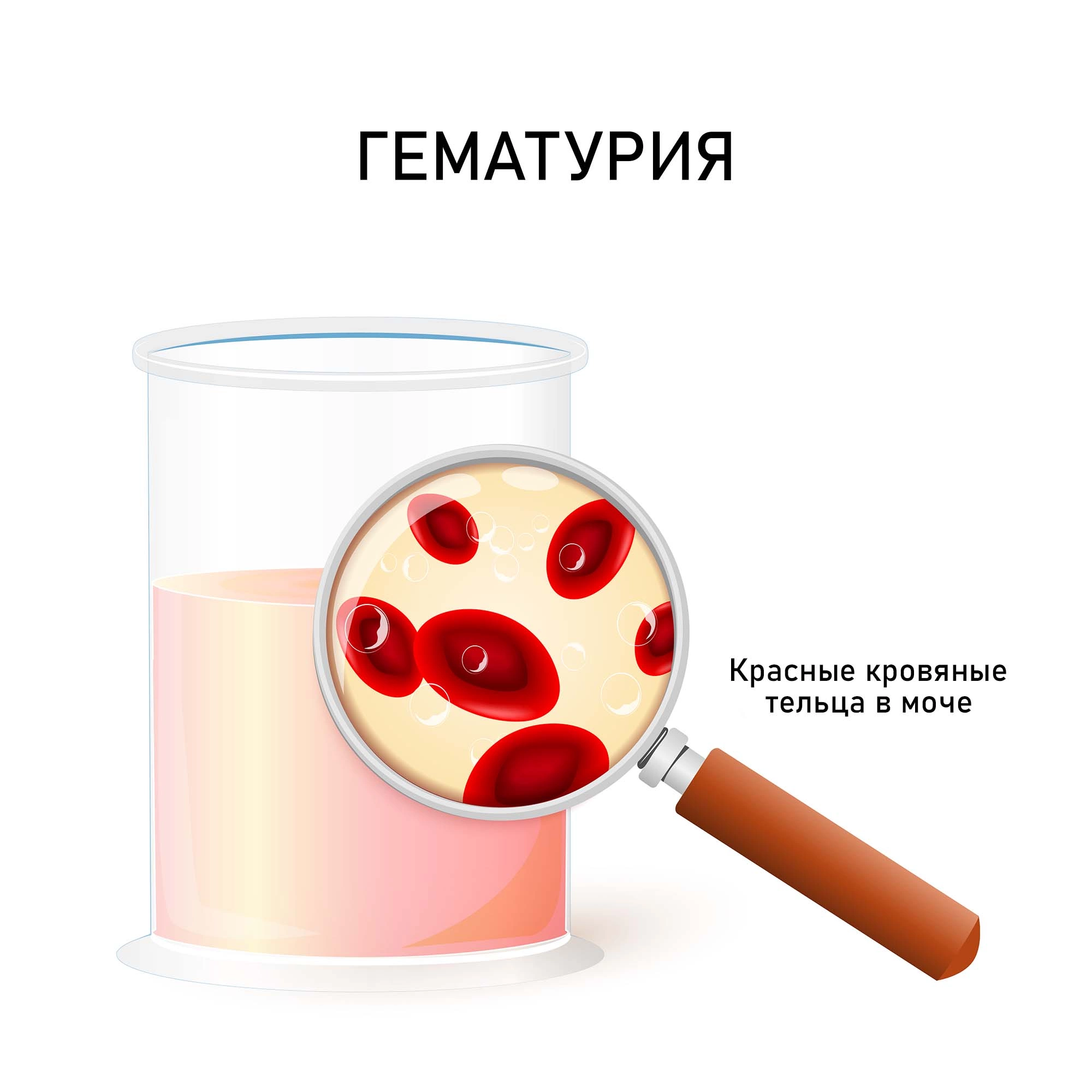 Может ли от свеклы быть красная моча у взрослого