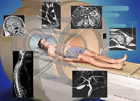 Мрт вреден ли для здоровья