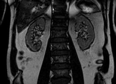 Мрт почек и мочевыводящих путей что показывает