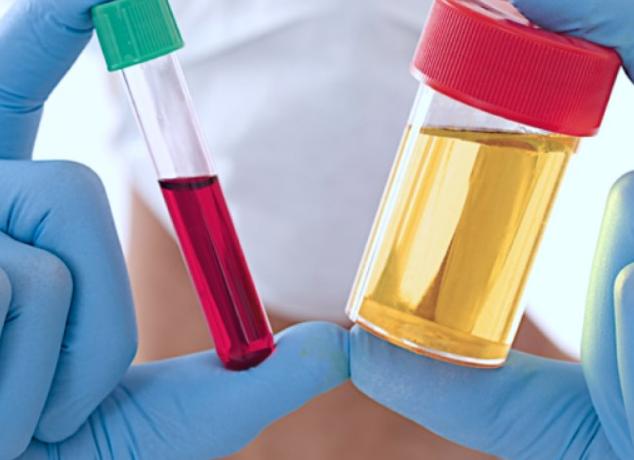 Кровь на уреаплазму