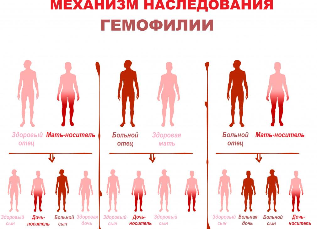 Болезнь не свертывания крови