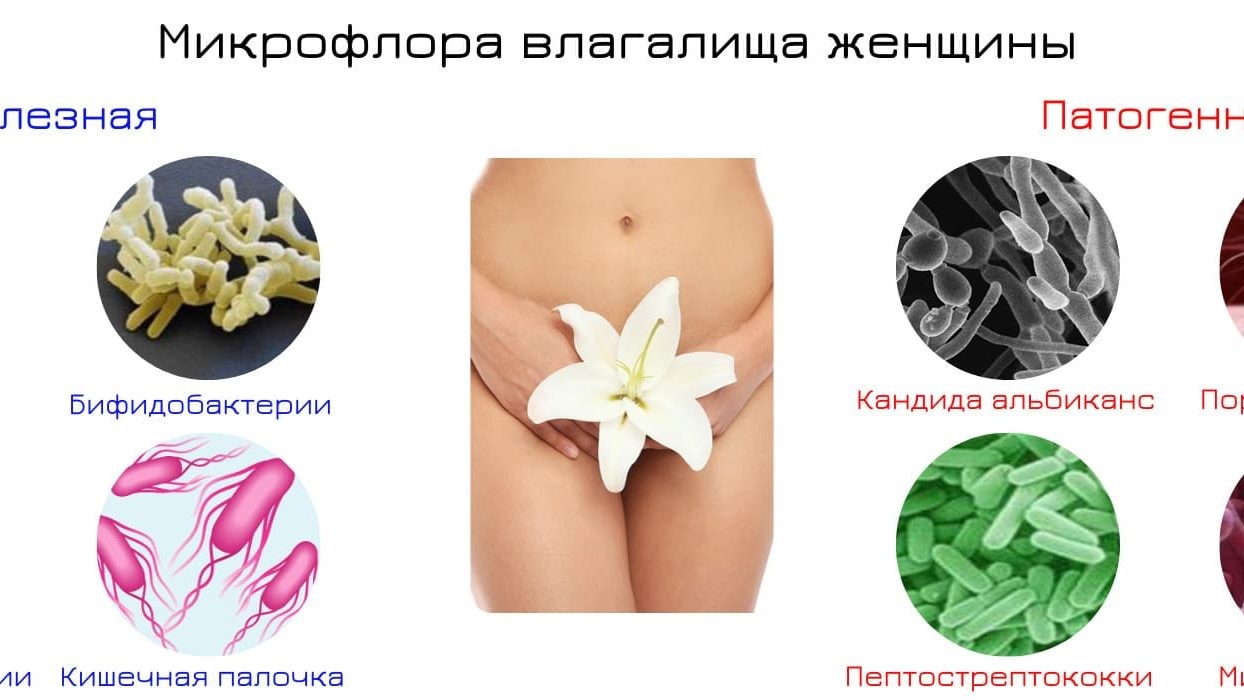Микрофлора у женщин