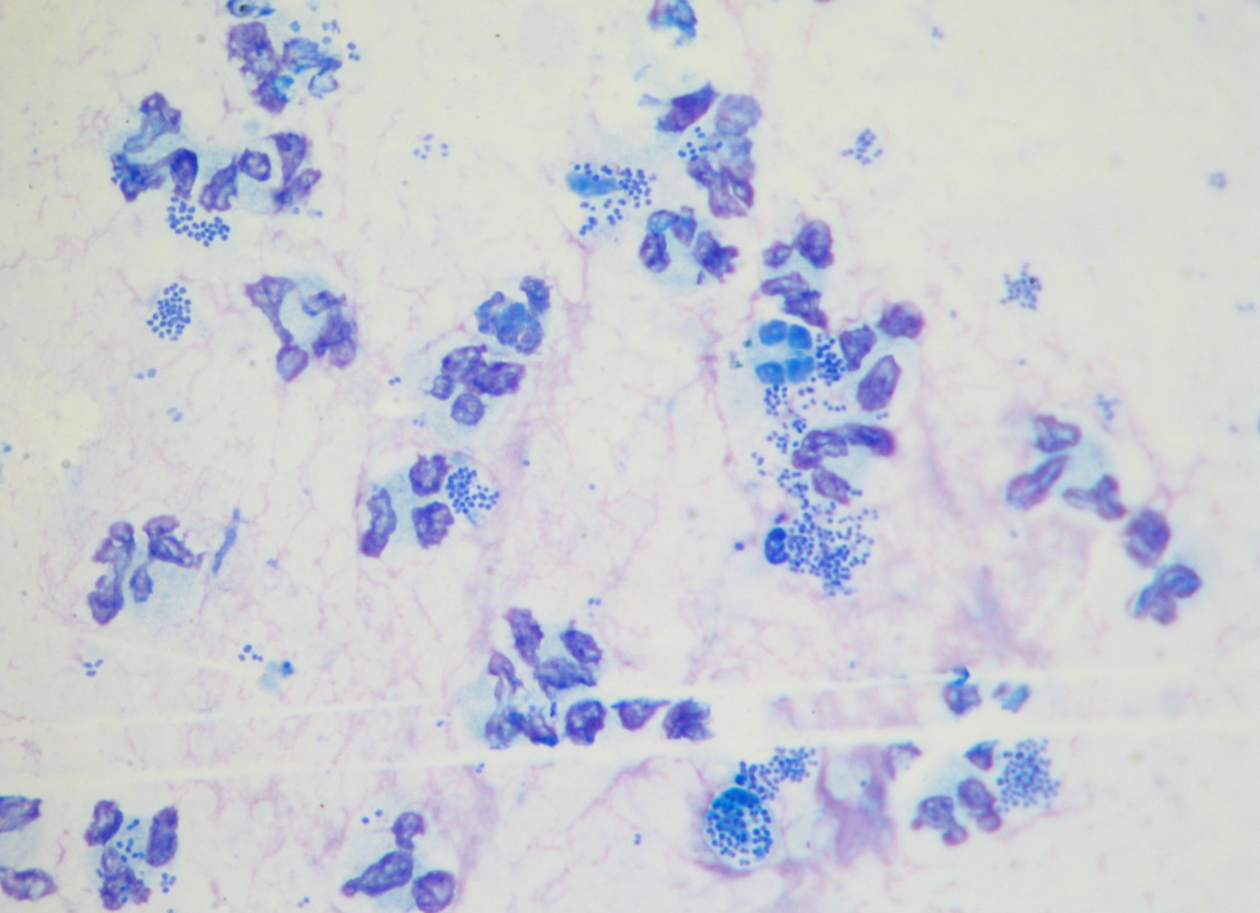 Микроскопическое исследование мазка расшифровка у женщин флора
