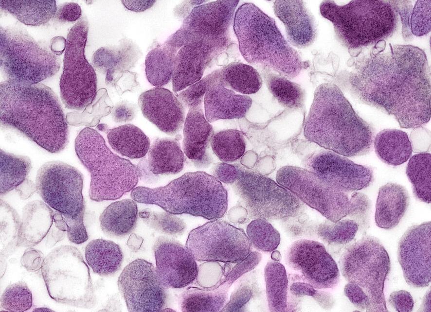 Мазок на микоплазму