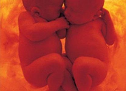 Как определить двойню без узи