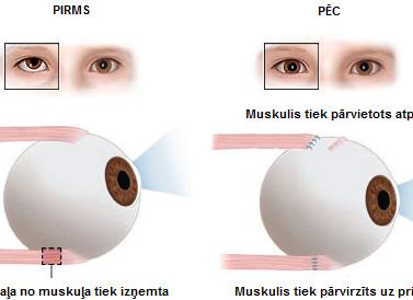 Идиопатия что это такое