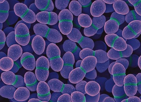 Энтерококк в мазке у женщин