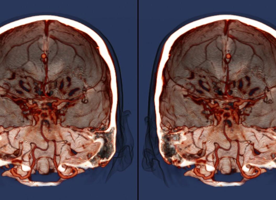Делают ли мрт головного мозга