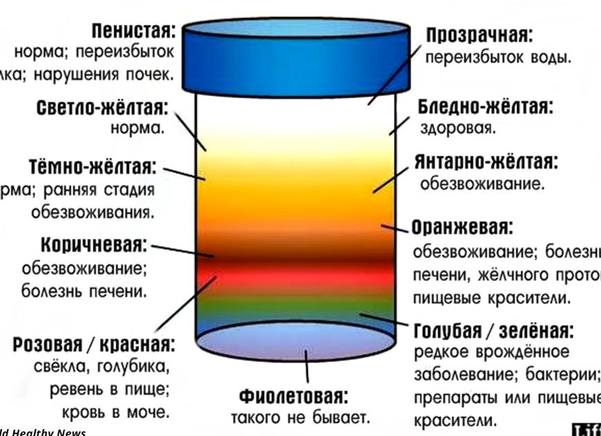 Цвет мочи изменился