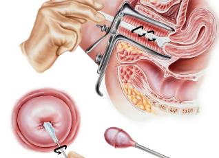 Цитологические исследования в гинекологии