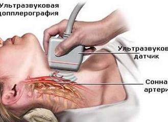 Что такое уздг сосудов шеи