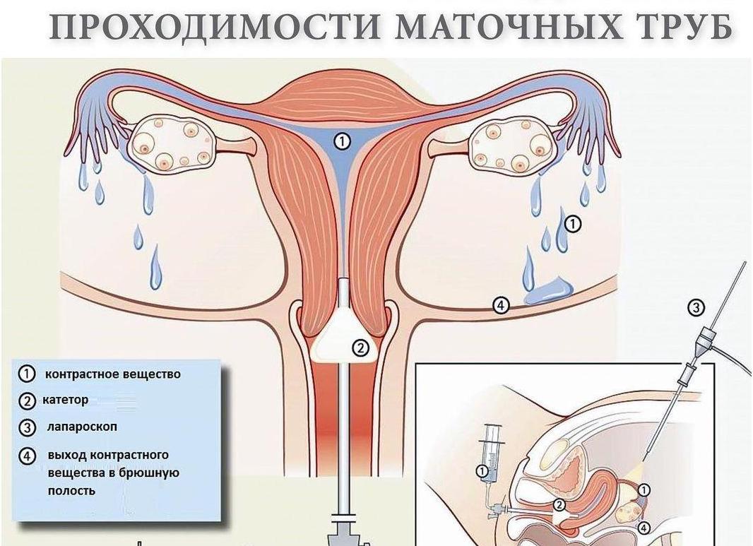 Анализ на проходимость труб
