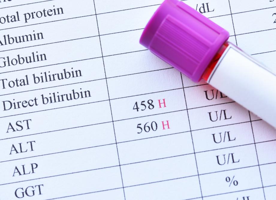 Алт анализ расшифровка