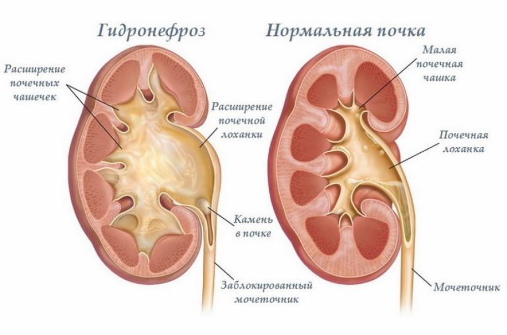 Как делают узи надпочечников у женщин