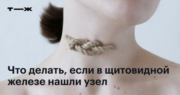 Как лечить узел щитовидной железы