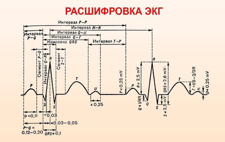 Кардиограмма сердца расшифровка норма