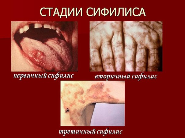 Кровь на эдс что это такое