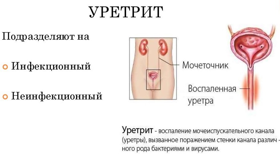 Мочевой канал у женщин болит