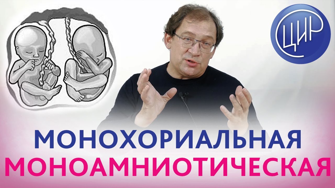 Монохориальная моноамниотическая двойня что это
