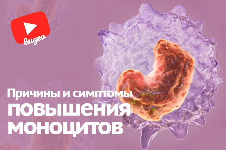 Моноциты повышены у взрослого причины
