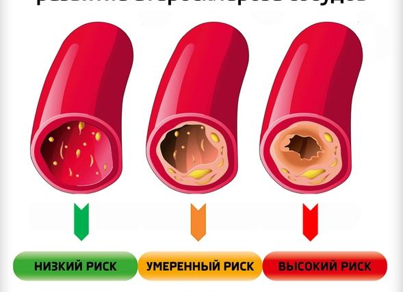 Липидный профиль что такое