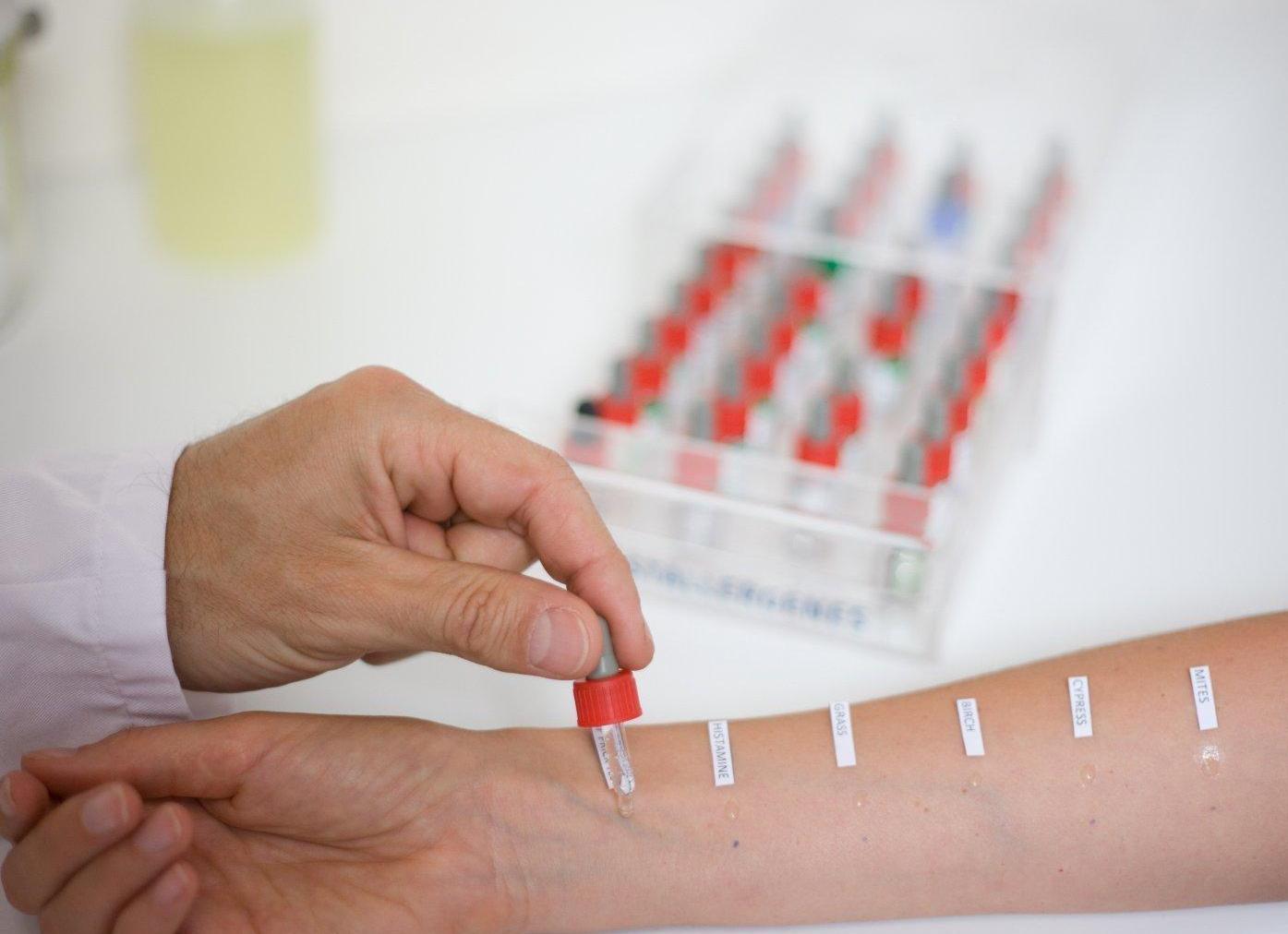 Кровь на иммуноглобулин е как сдавать натощак или нет Кровь на иммуноглобулин е как сдавать натощак или нет