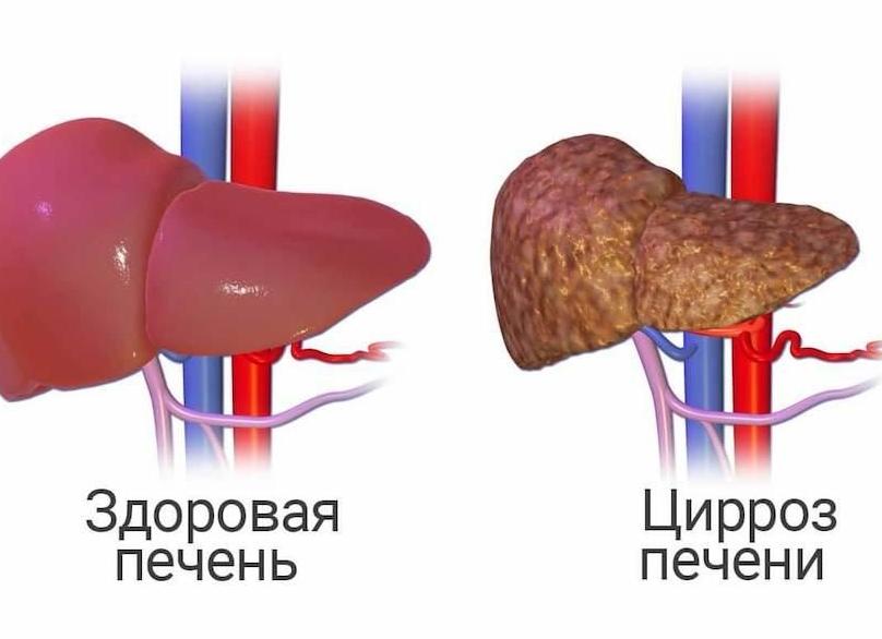 Креатин в моче